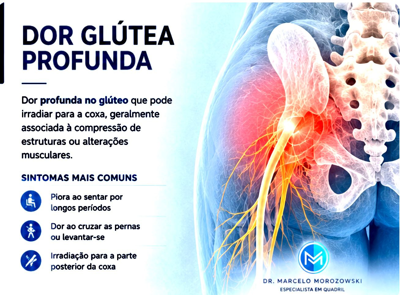 dor glutea profunda