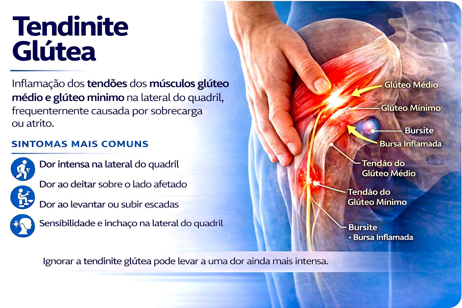 tendinite glutea
